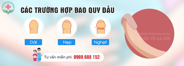 dấu hiệu bất thường của bao quy đầu