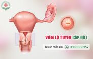Hình ảnh viêm lộ tuyến độ 1