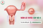 Hình ảnh viêm lộ tuyến cổ tử cung cấp độ 2