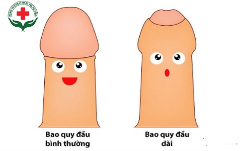 Dài bao quy đầu