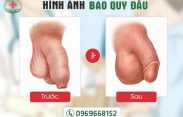 Hình ảnh trước và sau khi cắt bao quy đầu