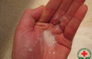 Vùng kín bị ngứa và có dịch trắng