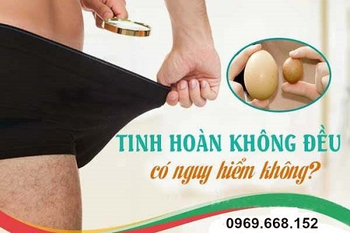 Tinh hoàn không đều nguy hiểm không