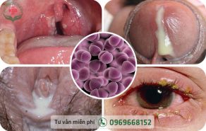 Hình ảnh bệnh lậu ở các vị trí