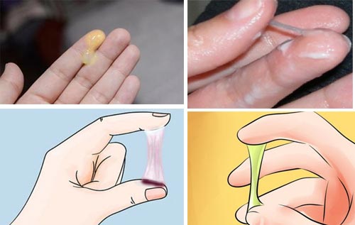 Biểu hiện viêm âm đạo