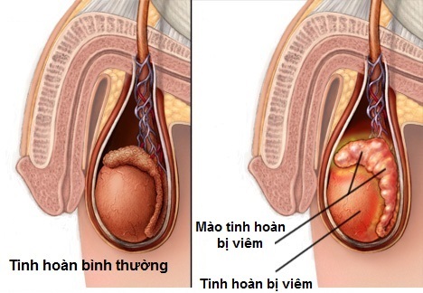 mao-tinh-hoan-co-cuc-cung